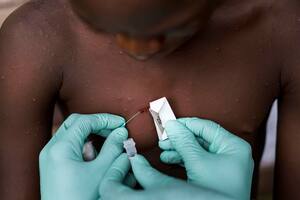 Un equipo del Centro de Control de Enfermedades investiga el virus de la viruela del mono en una aldea del norte del África Central.