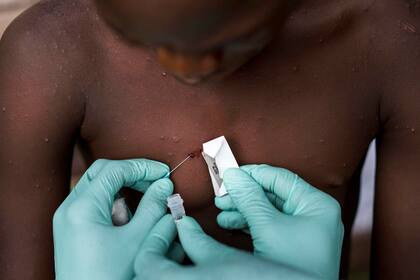 Un equipo del Centro de Control de Enfermedades investiga el virus de la viruela del mono en una aldea del norte del África Central.