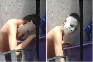 Un estudiante fabricó una máscara de yeso sobre su rostro y no pudo quitársela