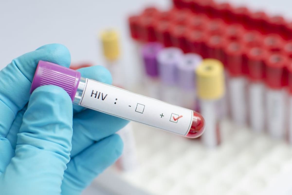 Un estudio de científicos españoles apuntó a los trasplantes de células madre como una posible vía para eliminar el VIH del organismo.