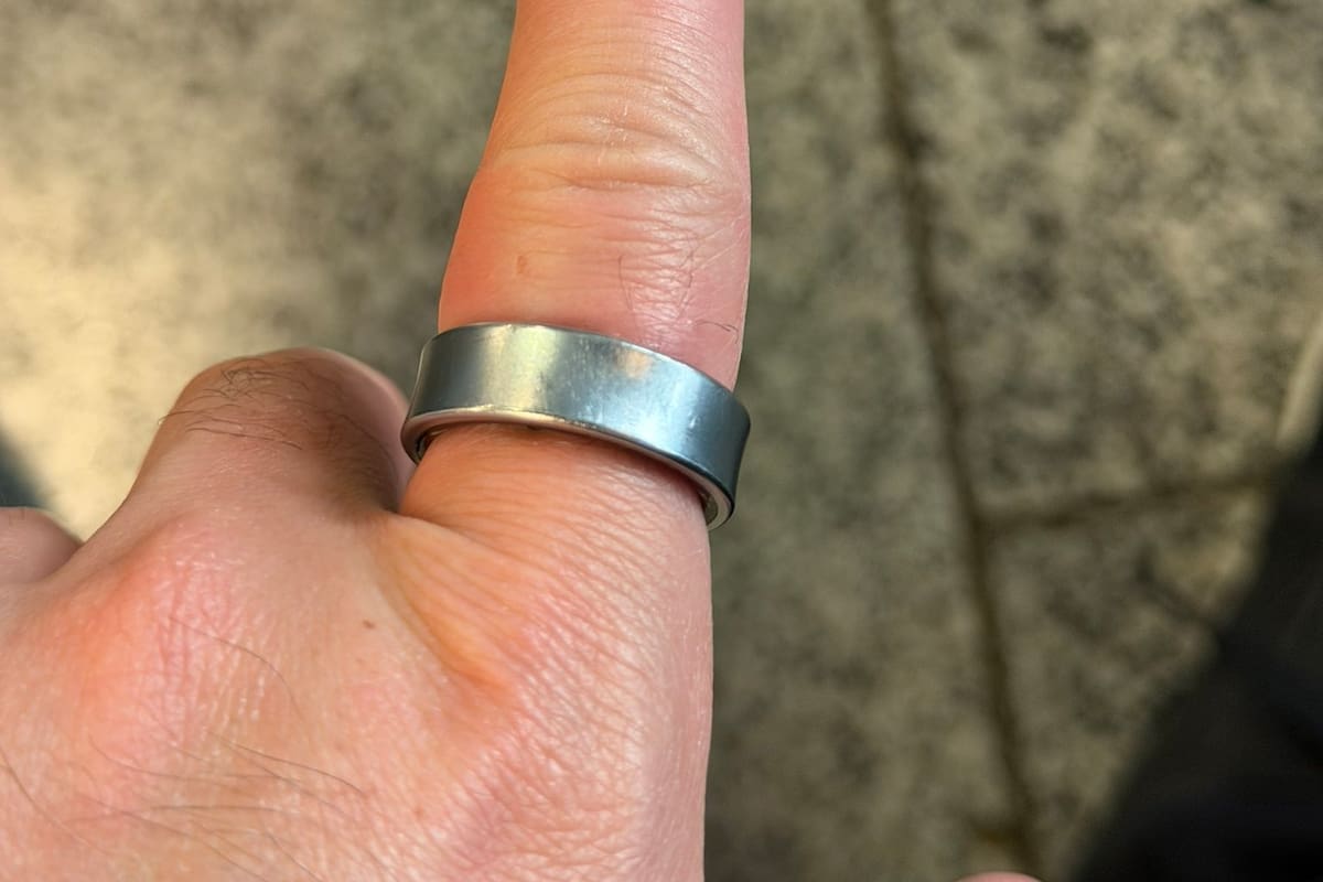 Un experto en tecnología relató en X cómo el anillo inteligente que estaba usando se hinchó por un desperfecto de la batería, al punto que no se lo podía sacar por su cuenta