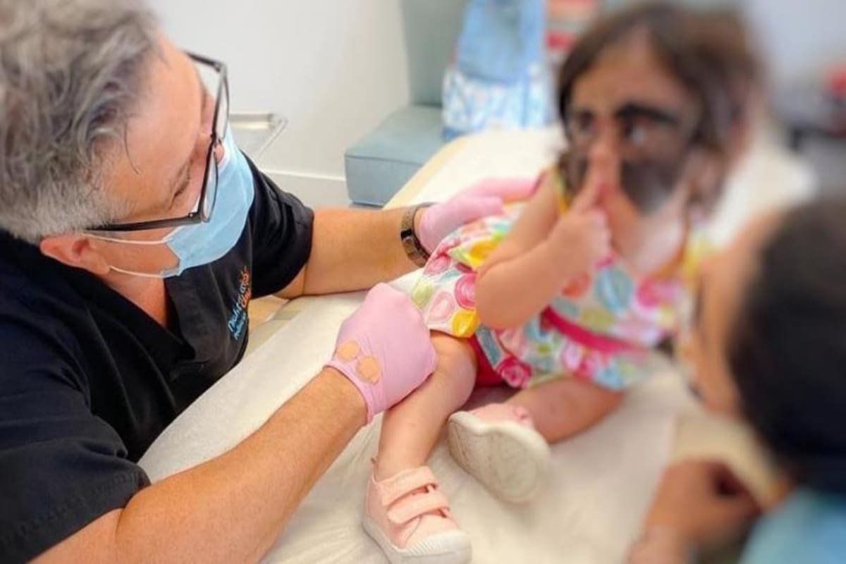 Un grupo de cirujanos rusos intervino quirúrgicamente a Luna Fenner para quitarle la marca de nacimiento que cubre gran parte de su rostro