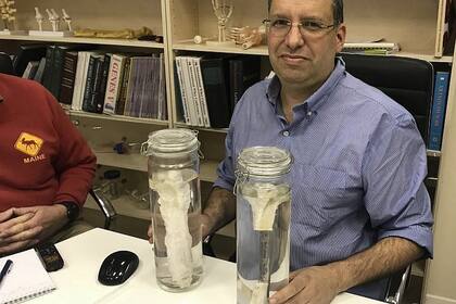 Un grupo de investigadores de Israel ha empezado el segundo ensayo de un estudio clínico que regenera huesos en un laboratorio. Se podría utilizar para el tratamiento de osteoporosis o lesiones originadas en accidentes