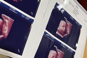 Denuncian que una clínica de Formosa usaba la misma ecografía para todas las embarazadas