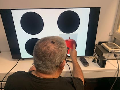 Un hombre con ceguera total causada por un daño irreversible en el nervio óptico ha recuperado parcialmente la visión natural tras participar en un ensayo clínico de estimulación eléctrica