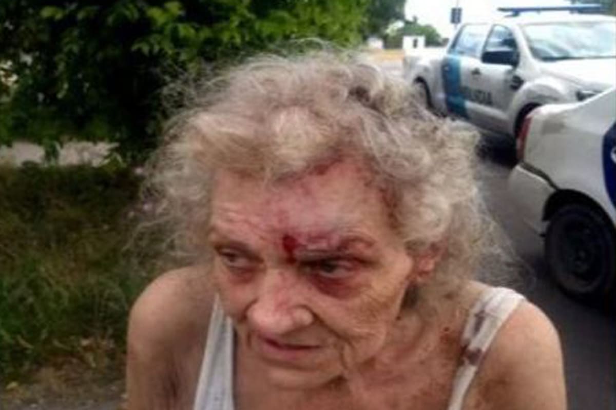 Un hombre desfiguró a su madre de 77 años