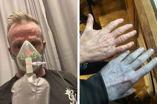 Se despertó azul, fue a la guardia médica de urgencia y el diagnóstico que recibió lo dejó atónito