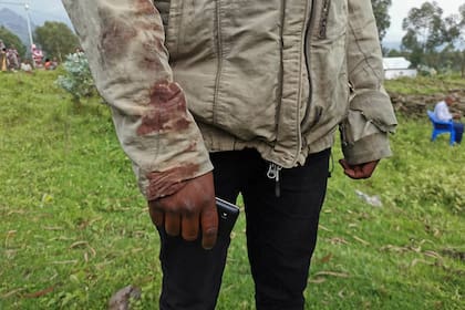 Un hombre que trató de ayudar al conductor herido del embajador de Italia en la República Democrática del Congo, Luca Attanasio, lleva una chaqueta manchada de sangre en el Parque Nacional Virunga, a 25 km de Goma, el 22 de febrero de 2021