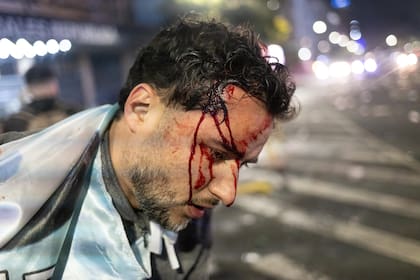 Un hombre resultó con una herida en su cabeza