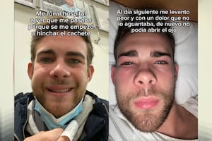 Un joven acudió al médico ante una hinchazón en la cara y tuvieron que operarle.