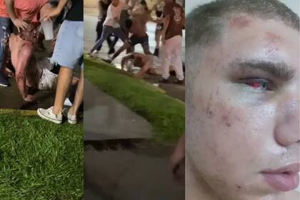 Un joven recibió una paliza a la salida de un boliche