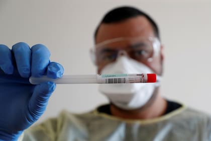 Coronavirus: un médico muestra un contenedor de muestras, en el hospital de Havelhoehe, en Berlín