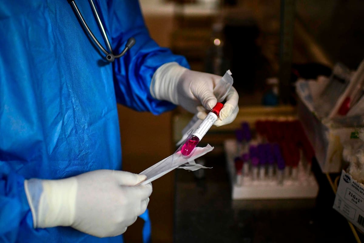 Un médico prepara una muestra de hisopado para ser analizada en el Hospital Eurnekian de Ezeiza.