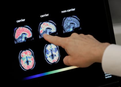 Un médico revisa una tomografía del cerebro