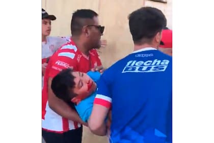 Un niño de 13 años terminó herido durante los incidentes en Unión, en los que 300 espectadores atacaron la sede del club tatengue luego del 0-0 con Lanús por la Copa de la Liga Profesional.