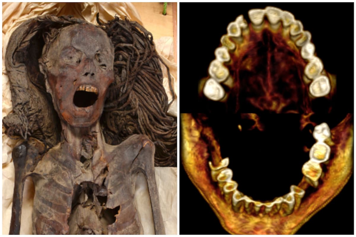 Un nuevo estudio arroja pistas sobre la causa de muerte de la "momia gritona"