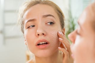Todo lo que tenés que saber sobre la última tendencia de la cosmética coreana para piel seca