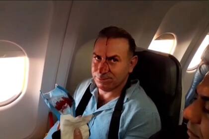 Un pasajero resultó herido luego de que el avión iraní perdiera altura súbitamente