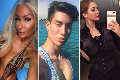 Un recorrido por las personas que se hicieron operaciones para parecerse a famosos y a personajes de ficción