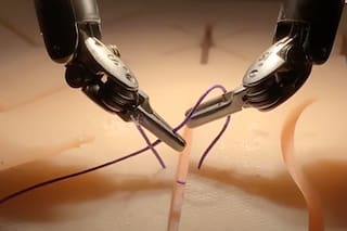 El robot que apunta a revolucionar la medicina