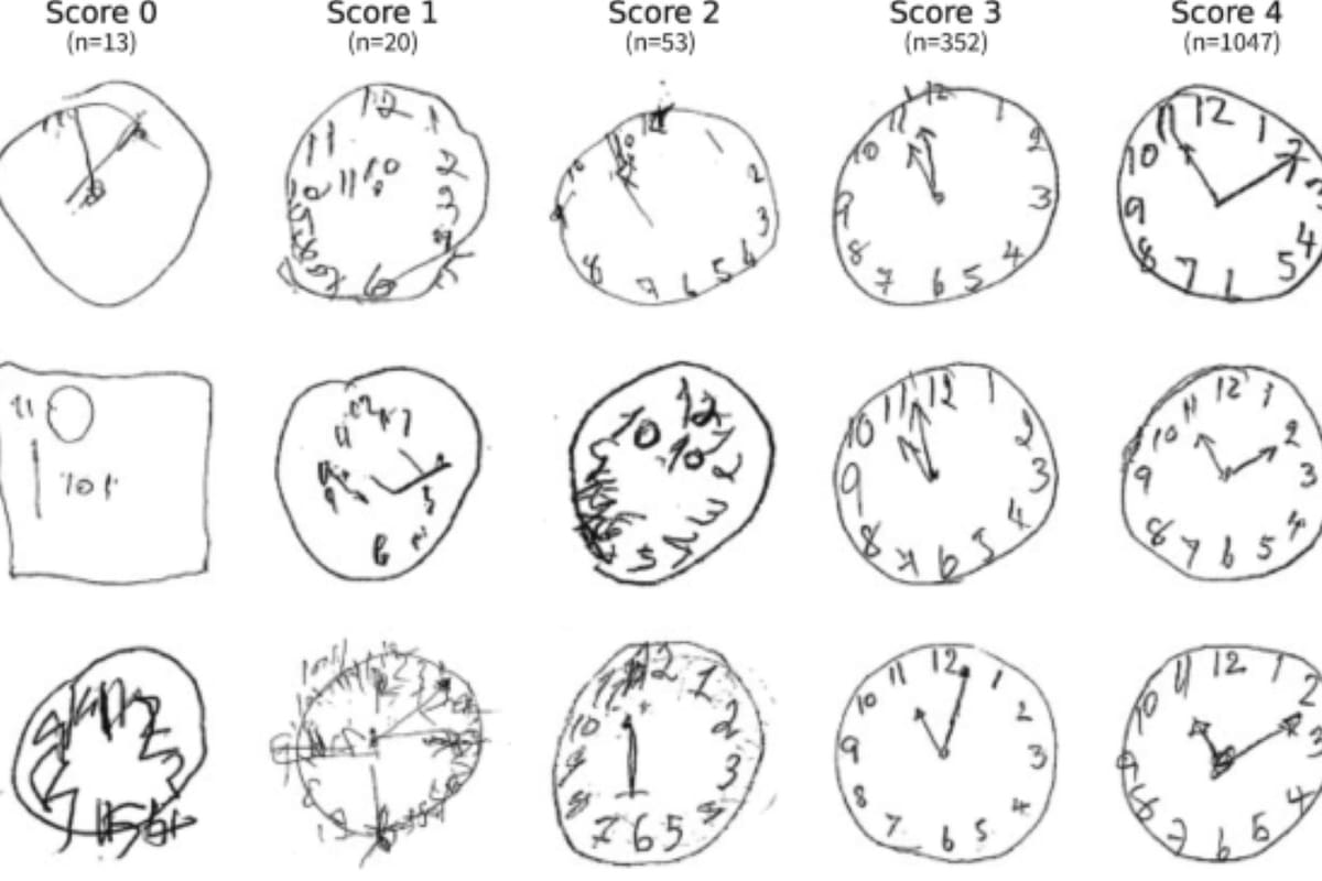 Un simple ejercicio, realizado desde casa y en apenas medio minuto, podría ser clave para detectar indicios tempranos de demencia (Imagen de X, antes Twitter)