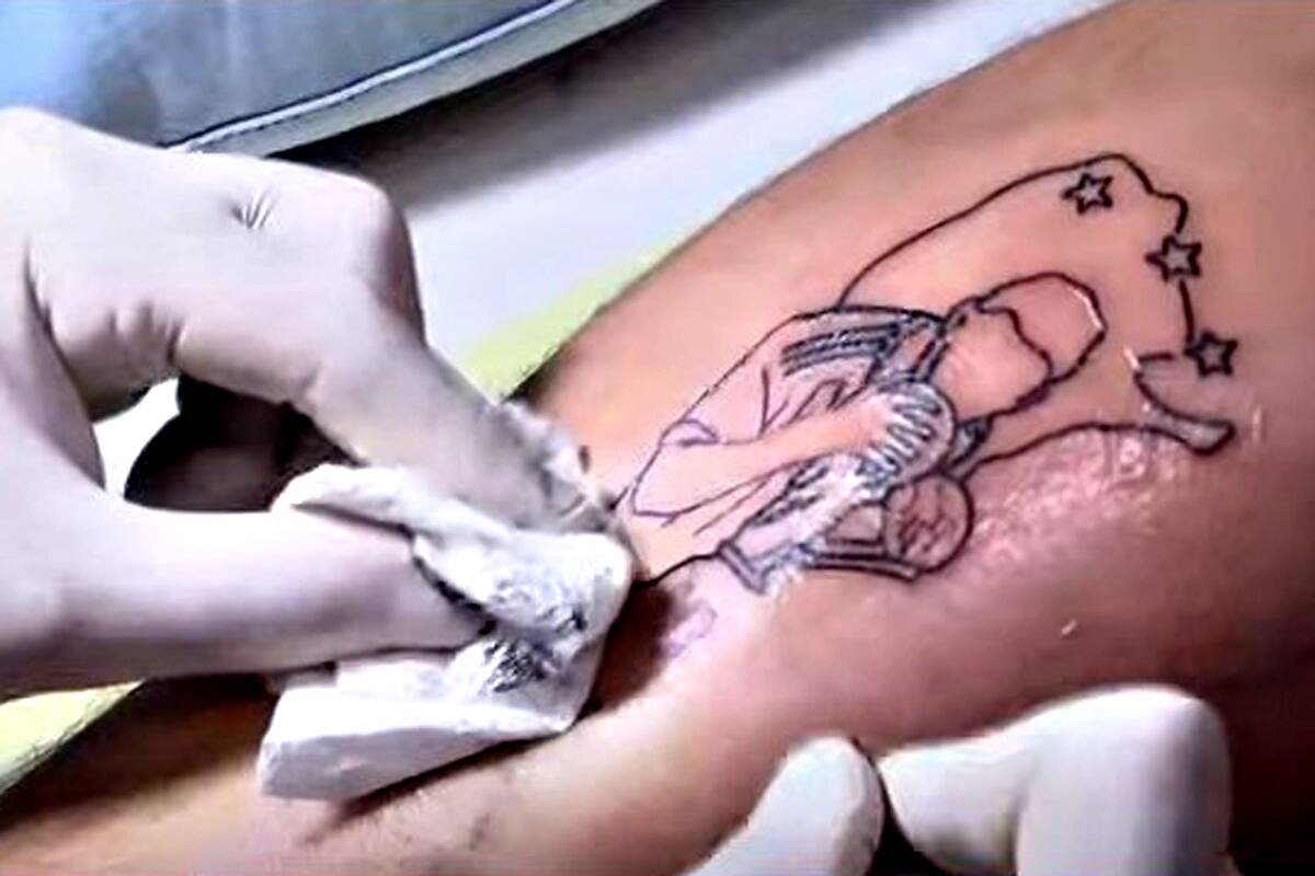 Un tatuaje de Messi con la copa en pleno proceso