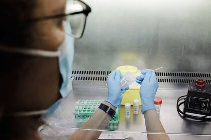 Un técnico de laboratorio sostiene una de las pruebas de análisis para la viruela del mono; la Argentina confirmó el noveno caso
