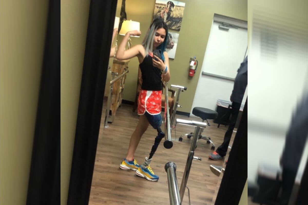 Un tiburón la atacó y su historia inspiró a millones.