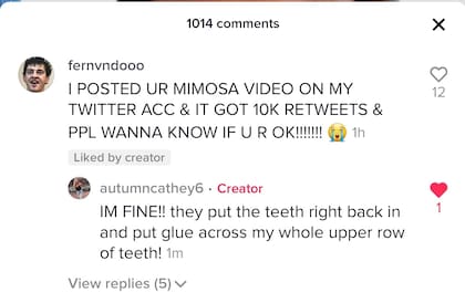 Un usuario le consultó a Autumn si estaba bien, luego de que se mostrara fuertemente golpeada en un video de TikTok.