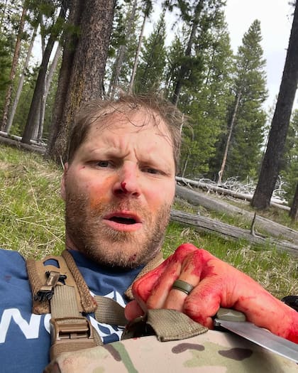 Un veterano fue atacado brutalmente por un oso pardo