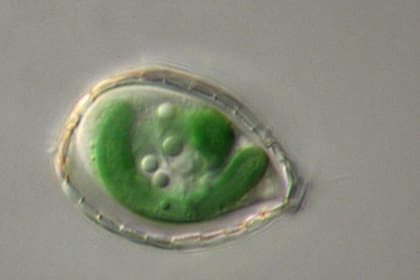 Una ameba del género Paulinella