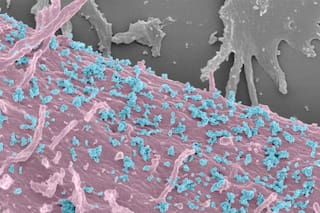 Un hallazgo genético podría facilitar el diagnóstico precoz del cáncer y mejorar el tratamiento de la diabetes