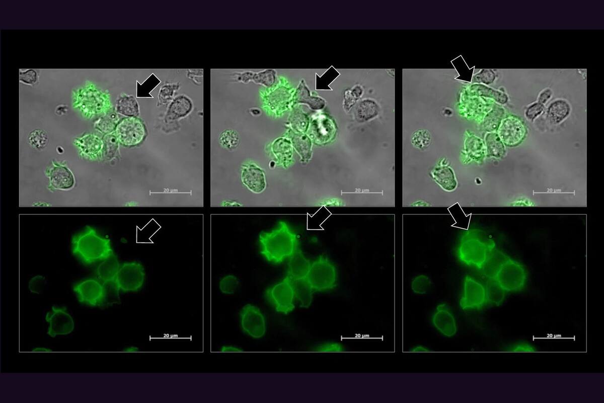 Una célula NK, señalada por una flecha, se vuelve verde tras robar un fragmento de la membrana de una célula cancerosa, también verde.