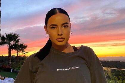 Una chica se rellenó los labios con ácido hialurónico, lo compartió en TikTok y el resultado impactó a todos