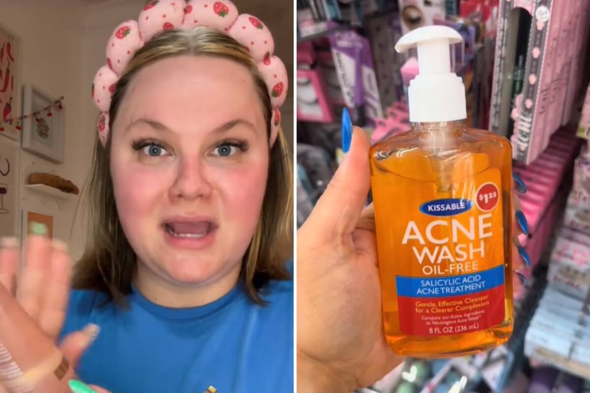 Una creadora de contenidos encontró en Dollar Tree el limpiador de acné más barato del mercado; cuesta US$1,25