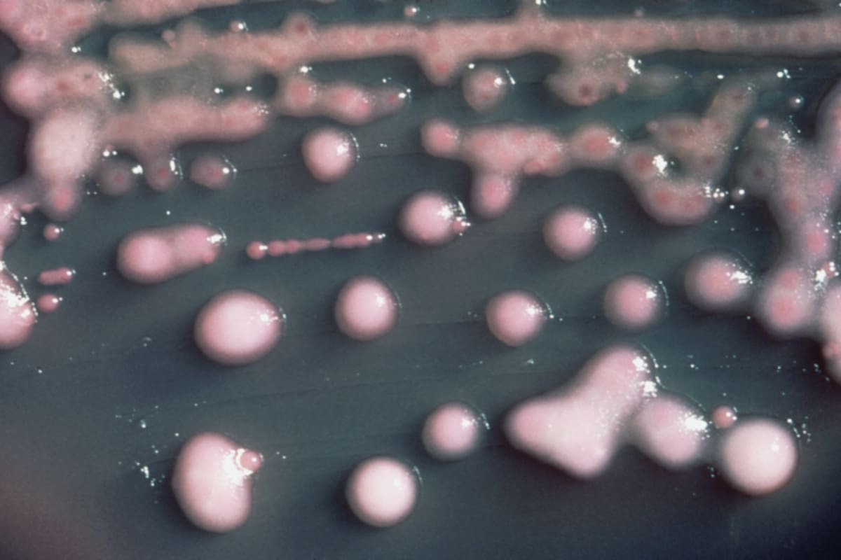 Una de las bacterias halladas es la Klebsiella pneumoniae