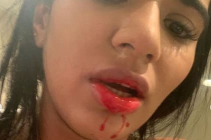 Una de las fotos que publicó Daniela Cortés, cuando acusó a Villa por violencia de género