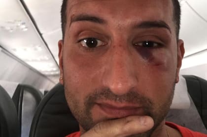 Una de las personas heridas, al abordar el avión