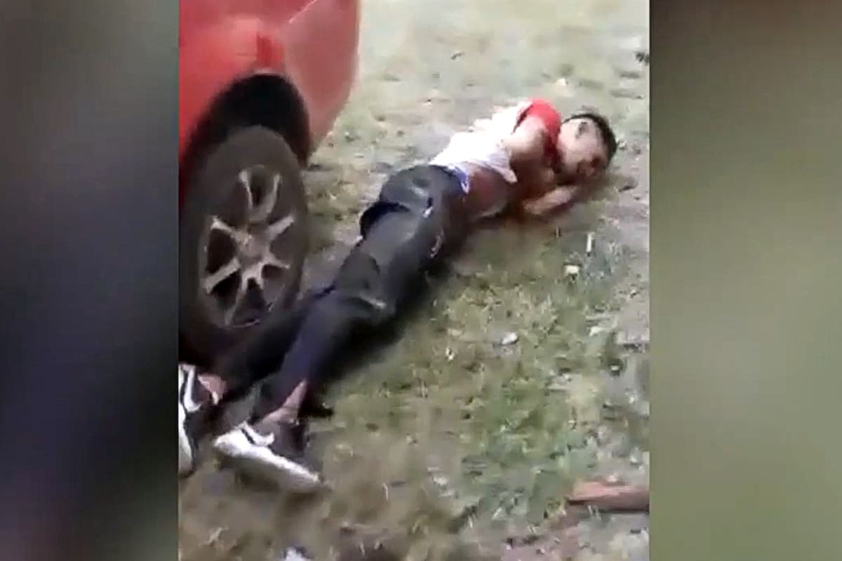 Una de las personas que recibió disparos de balas de goma