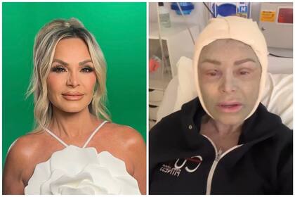 Una estrella de reality show mostró su cambio de cara luego de un procedimiento estético