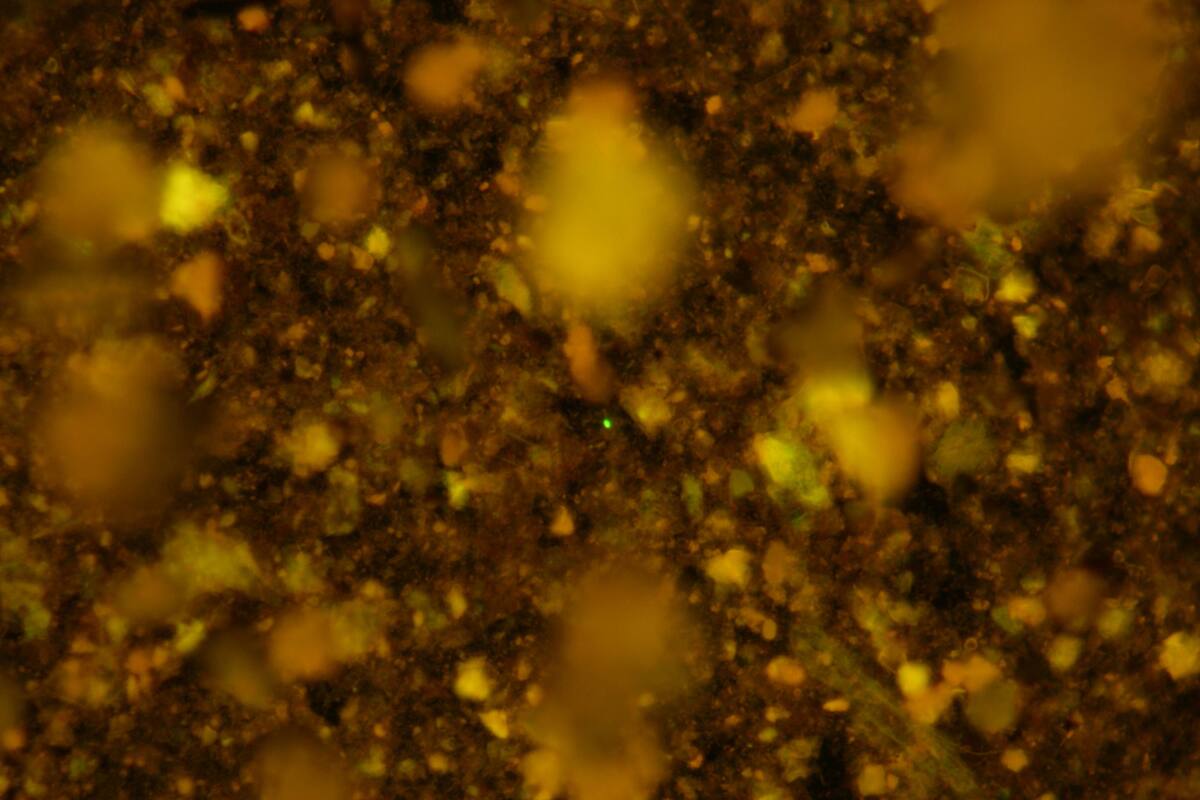 Una imagen obtenida de una de las muestras por medio de microscopía de fluorescencia