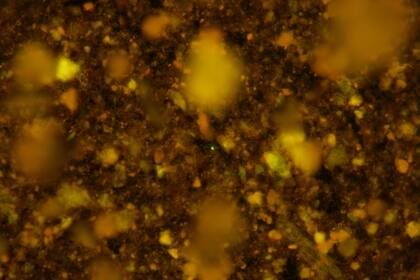 Una imagen obtenida de una de las muestras por medio de microscopía de fluorescencia