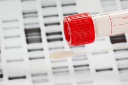 Una investigación encontró que hasta un 40% de los resultados de los tests que se venden en Estados Unidos, son falsos