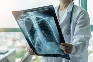 Un estudio abre una vía para anticipar y prevenir el cáncer que más muertes causa en el mundo