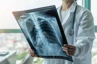 Un estudio abre una vía para anticipar y prevenir el cáncer que más muertes causa en el mundo