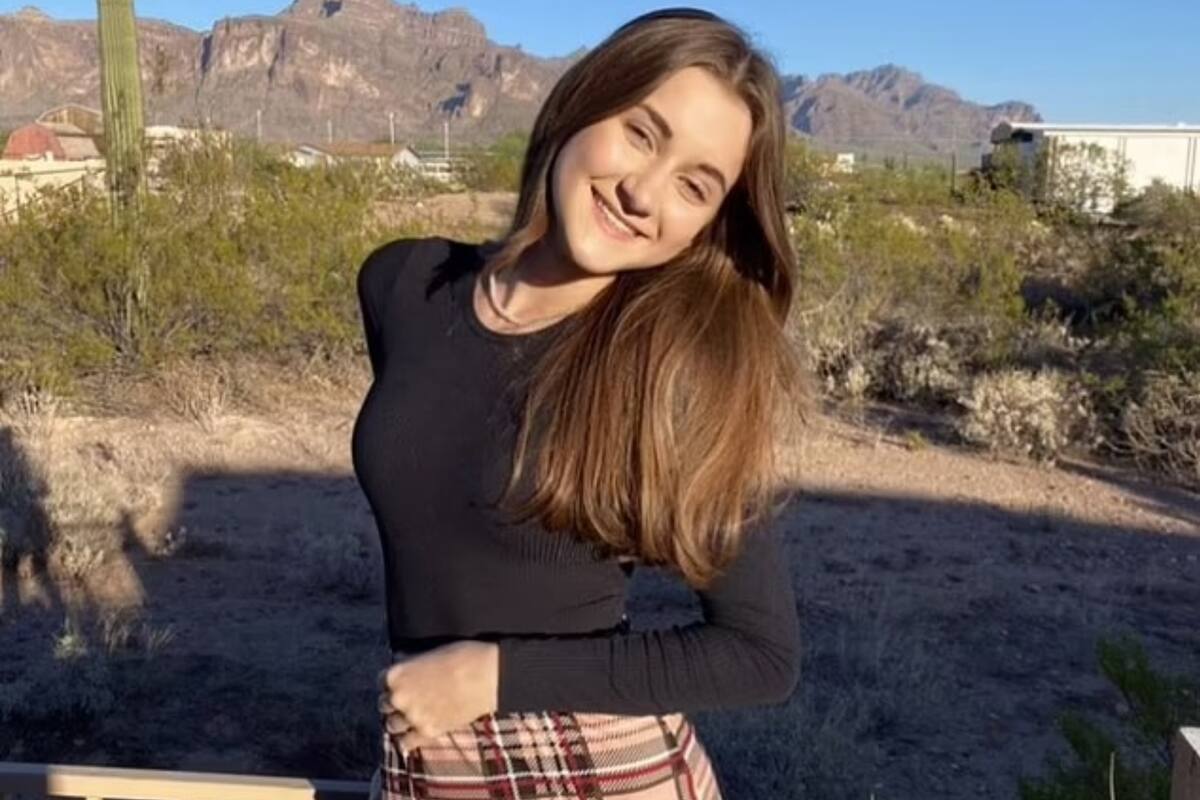 Una joven de 15 años es alérgica al agua: no puede beberla ni ducharse y cuando llora las lágrimas le queman el rostro (Foto: Kennedy News and Media)