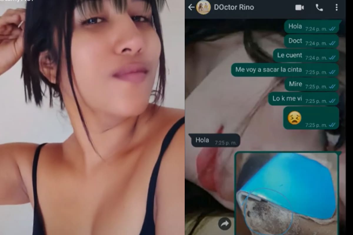 Una joven denunció una mala praxis en su rinoplastia (Captura video)