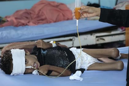 Una madre alimenta a su hijo desnutrido en un hospital de Yemen en septiembre