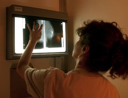 Es importante hacerse los controles correspondientes para controlar las mamas