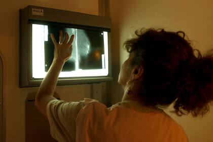 Una mamografía para detectar un posible caso de cáncer
